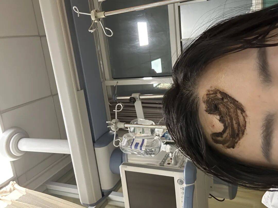 4名游客景区内遭马蜂袭击,旅游度假区:是森林公园不卖门票,蜇伤先就医后提供证据投诉